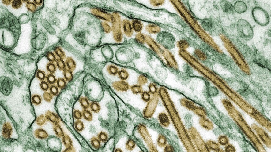 Virus de la grippe aviaire H5N1 (en or) cultivé au milieu de cellules MDCK (en vert) &mdash; Photo : Cynthia Goldsmith / CDC / Wikipedia Commons