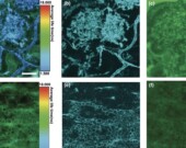 Une analyse au microscope électronique de la structure appelée arbuscule, créée par un champignon &mdash; Photo : Strullu-Derrien et al., New Phytologist