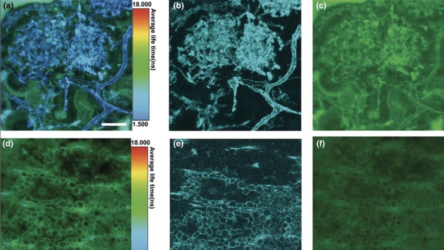 Une analyse au microscope électronique de la structure appelée arbuscule, créée par un champignon &mdash; Photo : Strullu-Derrien et al., New Phytologist